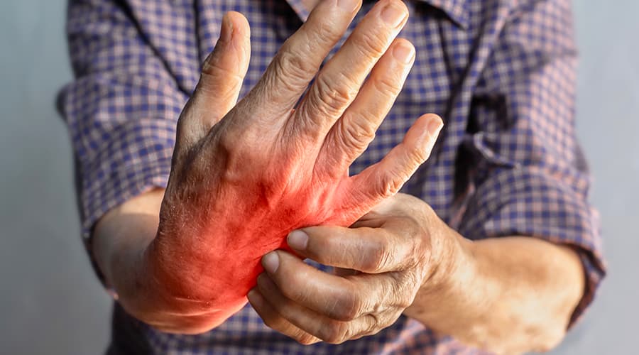 Osteoartritis